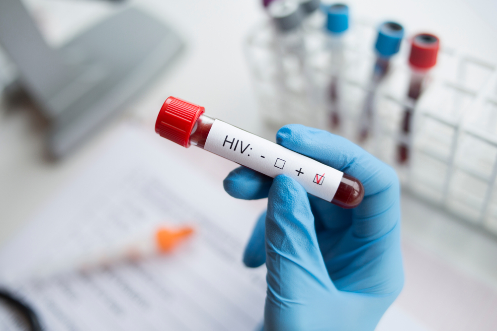 Oamenii de știință sunt optimiști în privința creării unui vaccin pentru HIV 